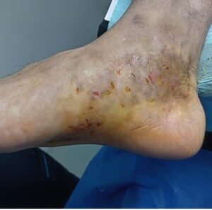 DERMATOMICOSIS-3.jpg