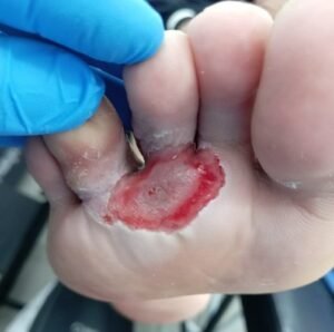 HERIDAS-7.jpg