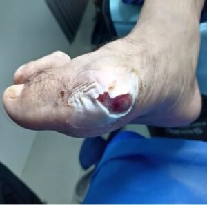 HOLEOMA-SEPTICO-8.jpg