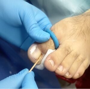 MATRICETOMIA-QUIMICA-16.jpg